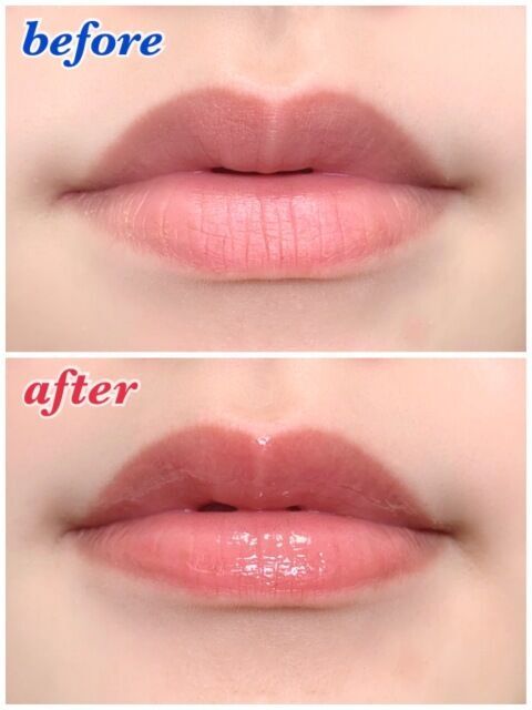 上：何もしていない唇、下：美容液プランパーを塗った唇