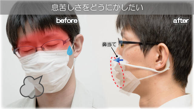 「マスクで耳が痛い」を解決　新発想の“マスクを軽くする”フレーム