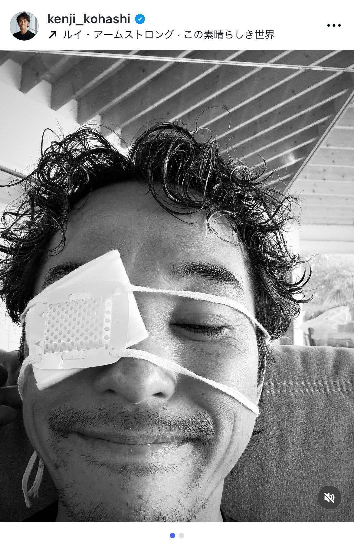 小橋賢児、サーフィン中の事故で顔を負傷「今年初めは大腿骨、今度は顔まで」