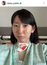 バレー元日本代表の江畑幸子さん、気管切開の手術を報告「急性喉頭蓋炎という病気が見つかり」