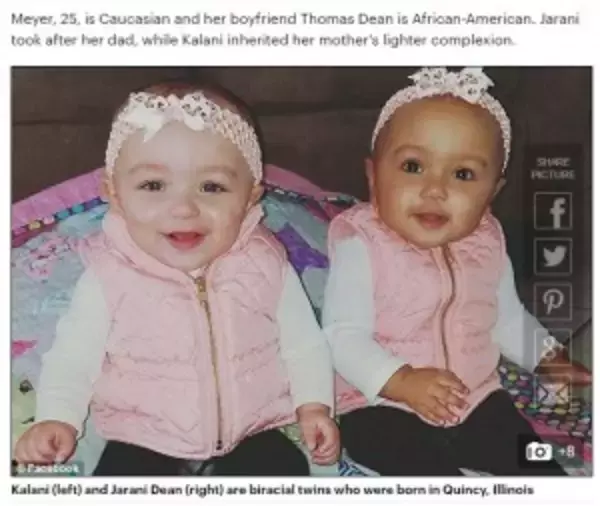 500分の1の確率！　白人と黒人カップルから生まれた肌の色が違う双子の赤ちゃん（米）