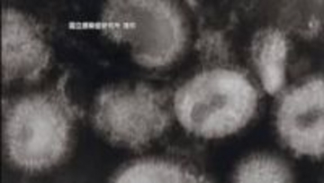 愛媛でインフルエンザ感染急増 西条保健所エリアは新型コロナも“注意報レベル”県が予防呼びかけ【愛媛】