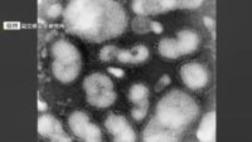 福岡県内のインフルエンザ感染者が増加 1医療機関あたり3.93人 前週の1.45倍に リンゴ病は24週連続で「警報レベル」