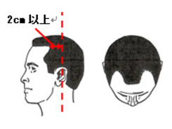 髪の毛が 玉結び になるのは妖精の仕業ではない エキサイトニュース