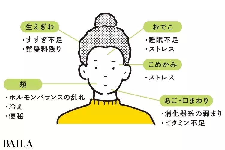 大人ニキビq A なかなか治らない大人ニキビ 思春期ニキビとの違いは 30代向けケアもアドバイス ローリエプレス