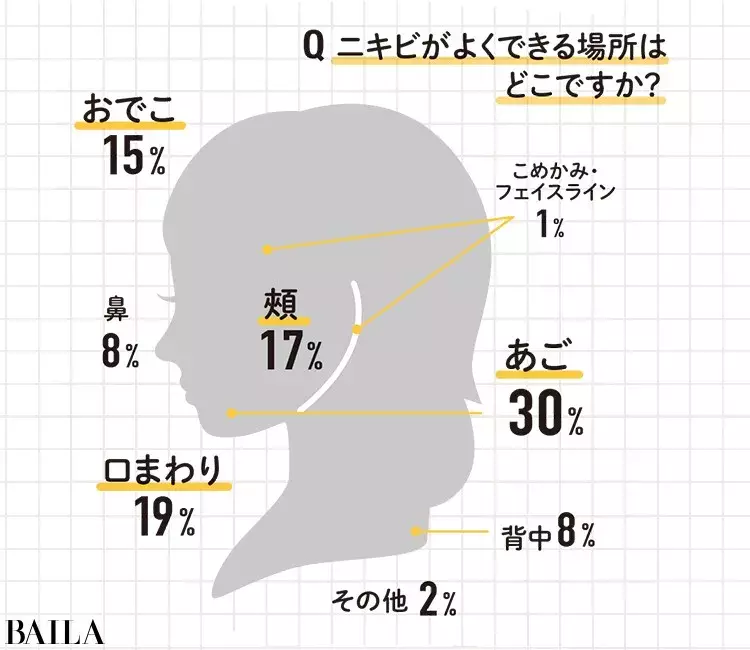 大人ニキビ 30代女子が気になる ニキビ に関するq A ローリエプレス