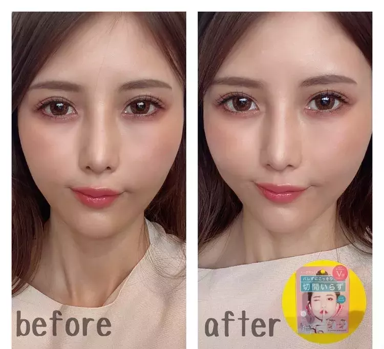 フェイスラインのたるみにおさらば 整形テープ こと 小顔キツネリフトテープ なら60秒でv字輪郭に Kidosayaの大人のプチプラコスメ ローリエプレス