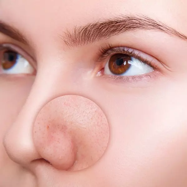 毛穴が気になる時にオススメのレスキューコスメ ローリエプレス