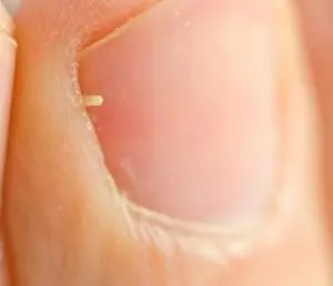 爪ケア実践編 初心者でも簡単な爪のお手入れ方法 ローリエプレス