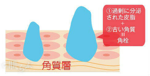 毛穴詰まりの原因って すぐに試したい洗顔 クレンジング 保湿とは ローリエプレス
