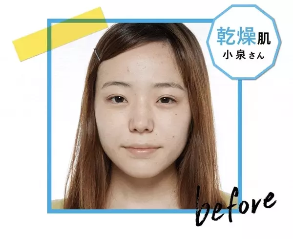 ニキビも乾燥も赤みにも効く 敏感肌コスメを1週間試した結果は ローリエプレス