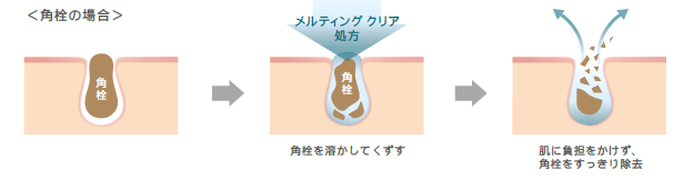 SUQQUから新しい毛穴用洗顔料が誕生。の2枚目の画像