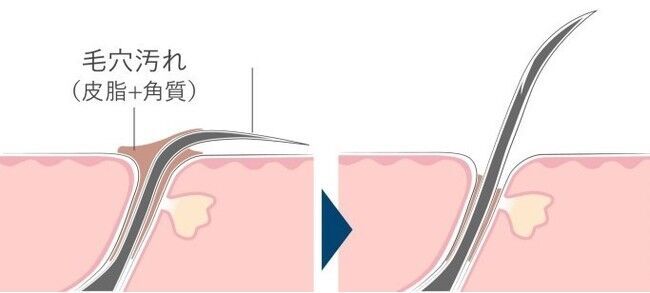 頭皮エステ初 2つの動きを1台に 引き上げる。もみ洗う。プロに学んだ多彩な手技を搭載した「頭皮エステ EH-HE0G」を発売の4枚目の画像