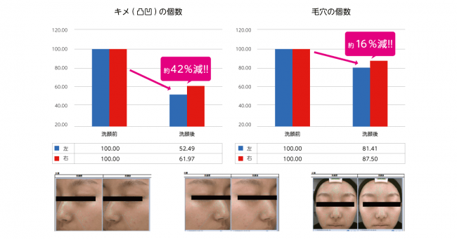 1回の使用で肌の凹凸が約42％も整う？！毛穴に特化した新ブランド「POAPOA（ポアポア）」から泡立て不要のクレイ洗顔料「ブライトクレイペースト」を2020年7月1日より発売開始！の4枚目の画像