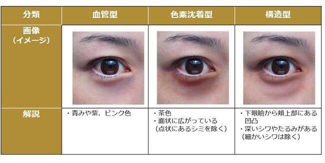 日本人女性の【クマ症状】の年代による変化を解析の3枚目の画像