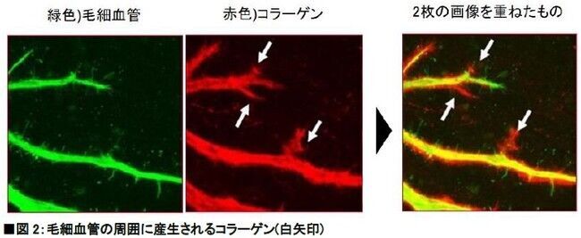 ゆるみ見せない目もと・頬に。　「つや玉」さらに輝くエリクシール新美容液「エステティックエッセンス」誕生　～2020年10月21日（水）発売～の7枚目の画像