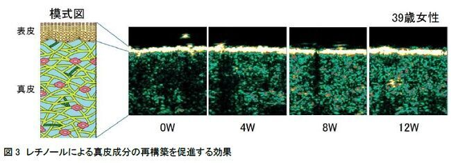 しわ改善薬用化粧品売上No.1※1 のエリクシールのリンクルクリームから「カバータイプ」誕生。～2021年2月21日（日）数量限定発売～の6枚目の画像