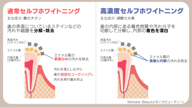 花嫁準備で行っておくべき｜ブライダルホワイトニングが低価格で効果抜群！の2枚目の画像