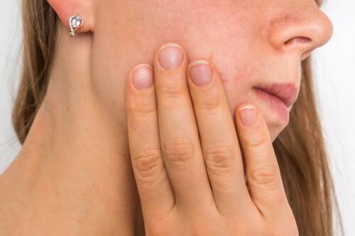 専門医が教える 気になる肌のざらざらの原因と対処法 ローリエプレス