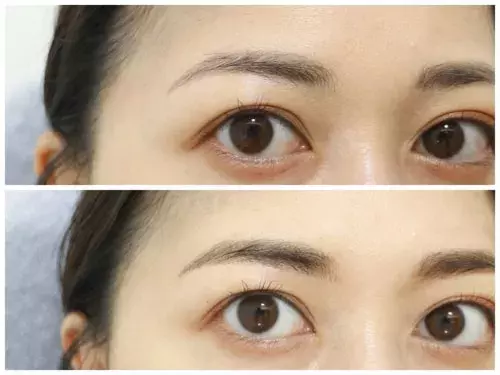 すっぴんでも理想の眉でいられる 最新の眉毛アートメイクを体験してみた ローリエプレス すっぴんでも理想の眉でいられる 最新の眉毛アートメイクを体験してみた ローリエプレス