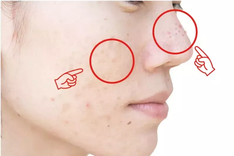 最近お肌の調子が悪い それってもしかしてマスクかも 肌に優しい コットンマスク３枚組 を発売 ローリエプレス