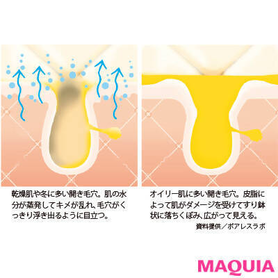 マキア世代ならまだ間に合う 開き毛穴 の改善に役立つお手入れ法 コスメ ローリエプレス