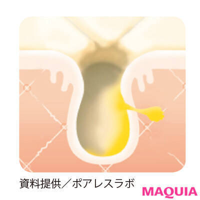 エイジングサイン たるみ毛穴 はどう解決する ハリ 活力アップテク ローリエプレス