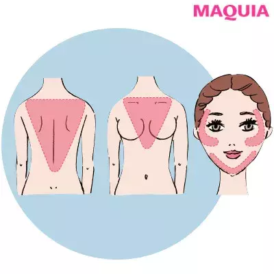 ニキビは遺伝 どうして繰り返す その悩みに女医が答えます ローリエプレス