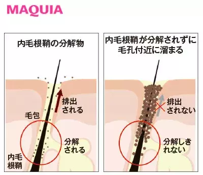 毛穴の角栓 黒ずみケア 洗顔 パック 化粧水など 毛穴対策におすすめのスキンケアまとめ ローリエプレス