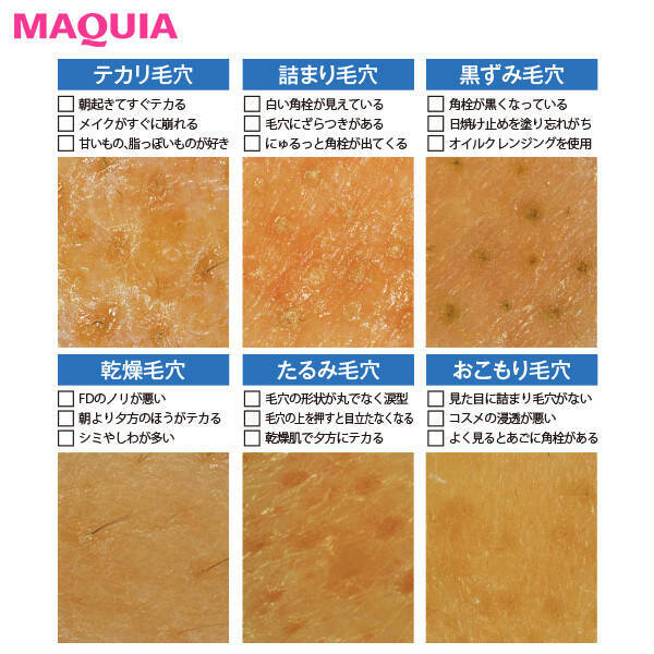 毛穴の角栓 黒ずみケア 洗顔 パック 化粧水など 毛穴対策におすすめのスキンケアまとめ ローリエプレス 毛穴の角栓 黒ずみケア 洗顔 パック 化粧水など 毛穴対策におすすめのスキンケアまとめ ローリエプレス