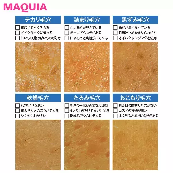 毛穴タイプがわかるチェック診断つき 毛穴ケアのお悩み解決q A ローリエプレス 毛穴タイプがわかるチェック診断つき 毛穴ケアのお悩み解決q A ローリエプレス