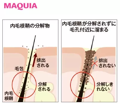 毛穴タイプがわかるチェック診断つき 毛穴ケアのお悩み解決q A ローリエプレス