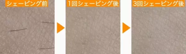 目指せツルスベ肌 カミソリ負け知らずなシェービングの仕方 ボディ編 ローリエプレス