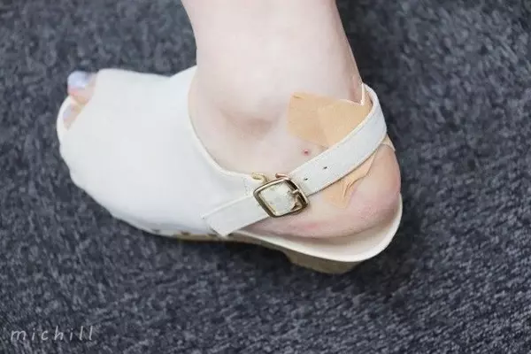 靴ずれ緊急対策 サンダルの季節に欠かせない 剥がれない絆創膏の貼り方 ローリエプレス