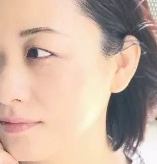 リンクルショット の効果は 本当にシワは消えるのか ミドサー編集者がガチで1か月試してみた ローリエプレス リンクルショット の効果は 本当にシワは消えるのか ミドサー編集者がガチで1か月試してみた ローリエプレス