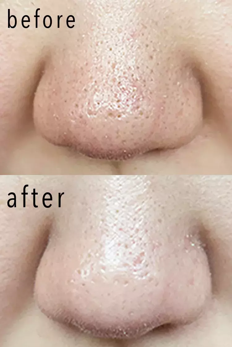 毛穴汚れを一掃 つるんと美肌になる シリコーン製電動ブラシ 天然毛 を試してみた ローリエプレス