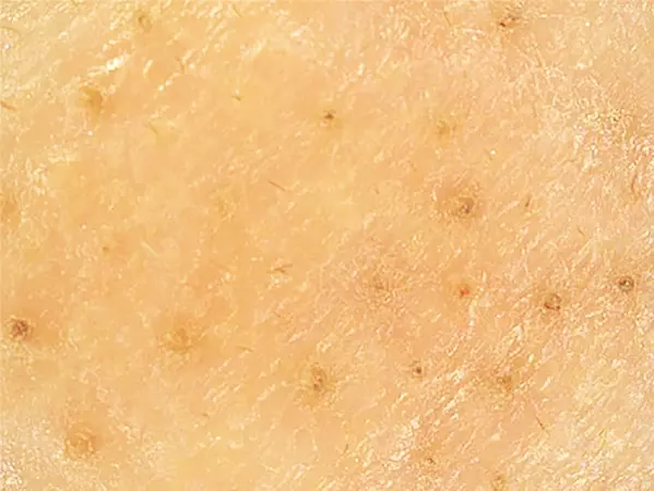 プツプツ毛穴 をごっそりオフ 肌に優しい毛穴ケアアイテム3選 ローリエプレス