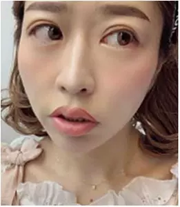 整形してよかったのは 眉毛 唇のアートメイク 韓国美容クリニック経験者のホンネ ローリエプレス