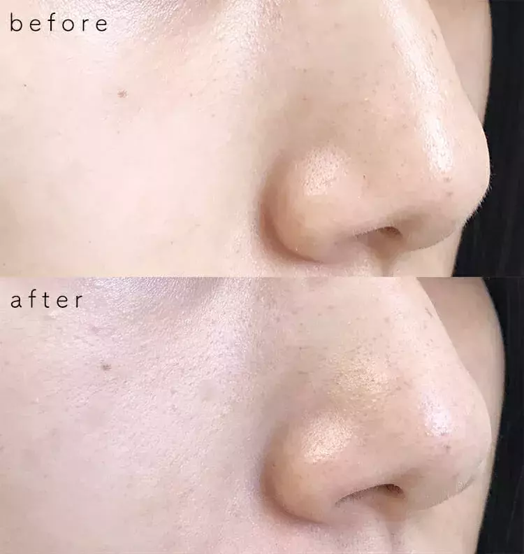 毛穴をちゃんと隠したい 毛穴さよならコスメ を試してみた ローリエプレス