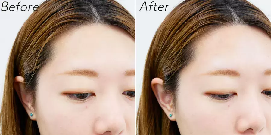 驚くほど顔の印象が変わります おでこ美人メイク をレクチャー ローリエプレス