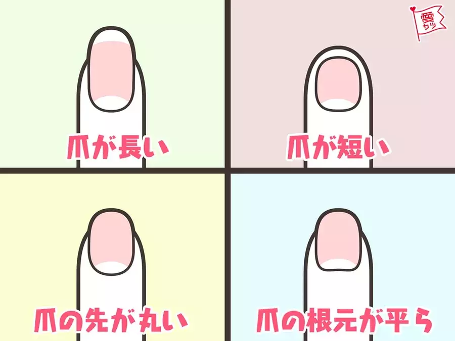 爪の形でわかる 彼の 恋愛的性格 ローリエプレス