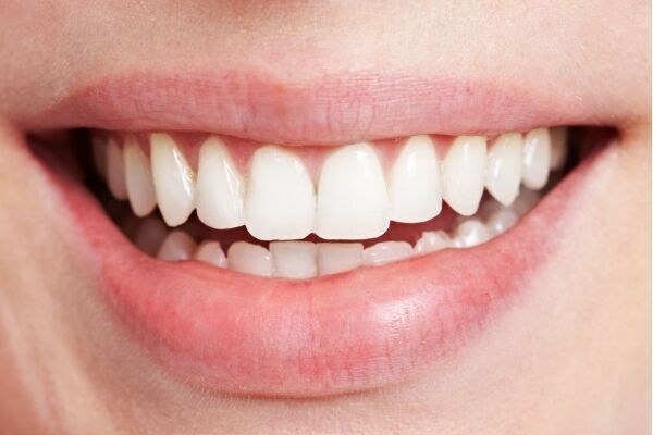 【キレイな白い歯に】歯磨き粉で簡単に自宅ホワイトニング♥の8枚目の画像