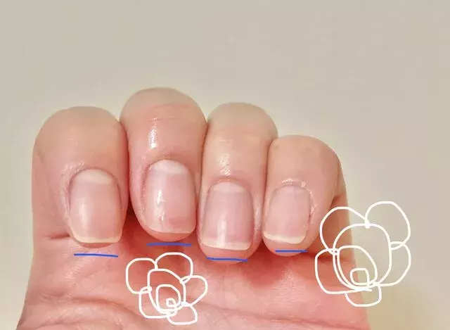 深爪に悩む方必見 ネイルサロンで深爪改善 ローリエプレス