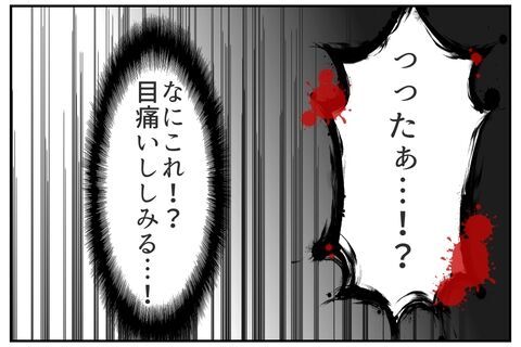 急に何？顔に刺激物を塗りつけて爆笑するヤバい二人【これってイジメ？それともイジリ？ Vol.29】の4枚目の画像