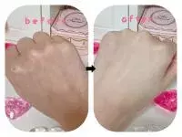 膝の黒ずみをさっぱり消したい おすすめの対策 ケア方法を大公開 ローリエプレス