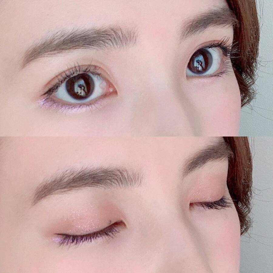 二重はマッサージで手に入る 重たい一重におすすめのマッサージ方法も一挙公開 ローリエプレス