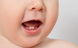 虫歯はどうする 生える順番は 乳歯のケア方法まとめ ウーマンエキサイト