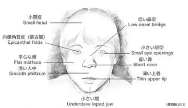 特徴的な顔つきや知的障害の子を産むのは「リスク」？　国が進める「プレコン」に潜む問題点とは 妊娠の知識のはずが優生思想につながっている…【やまゆり園事件１０年】