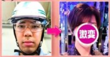 整形費用330万円で激変！髙橋海人似ホストのビフォーアフターに衝撃「これは人生変わる」「整形顔っぽくない」