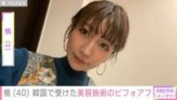 “3度の二重整形” 桃（40）、 韓国で顔の美容施術受けたビフォアフ公開 帰国時にはまさかの出来事